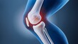 © Mdragon - Emphasis on internal compression of the knee joint due to cruciate ligament injury