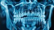 © ulf mine - Dental, scan and illustration of teeth in mouth for radiology, assessment and oral examination. Medical, 3d xray and skeleton in anatomy with healthcare for surgery, investigation and evaluation