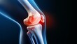 © Mdragon - Graphic representation highlighting inflamed and blurred tissue around the cruciate ligament