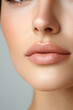 © Fabio - Young woman with Botox-treated lips, looking directly at the camera
