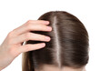 © New Africa - Girl with hair loss problem on white background, closeup