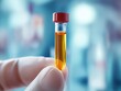 © Espresso - A close-up of a hand holding a test tube filled with yellow liquid, showcasing a clinical and hygienic environment.