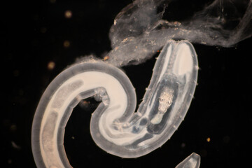 Wall Mural - Cyctacanth stage (Acanthocephala) fish cestode larva (Trianchoratus sp.) in Channa striata under the microscope in Lab.