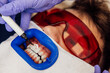 © VICTOR TORRES/Stocksy - Dental whitening procedure with protective eyewear and tools