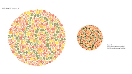 Eye Color vision test, Color Blindness Test Plate 20, Ishihara, Plate 30, Normal view: Blue-Green line, Red-Green Deuteranomaly: Nothing.