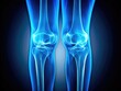 © Autun - Fashion meets medicine: a stylish, blue-toned X-ray reveals mild knee osteoarthritis.