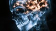 © mangolovemom - A luminous, digital representation of a human skull, showcasing neural connections and brain activity with vibrant lights against a dark background.