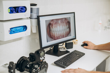 Dental professional examines detailed teeth image on computer screen in clinic