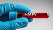 © Ketanoff - A hand in a blue glove holds a test tube labeled hMPV, containing blood. This is part of ongoing research on metapneumovirus in China during 2025