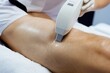 © Dina - laser epilation for man in process at beauty salon on arm or leg hairs closeup