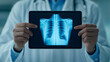 © PTC_KICKCAT - health info patient and compliance concept. Doctor holding an X-ray image of lungs on a tablet device.
