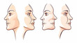 © Lailatul - Woman's face aging stages profile view illustration, cosmetic surgery before and after
