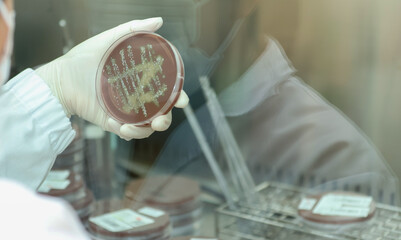 Laboratory technician analyzes culture in petri dish, To diagnose gonorrhea accurately, laboratory technicians incubate samples in an environment control.