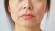 © anna - Woman's Portrait Showing Before and After Beauty Transformation