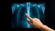 © SusDmi - Female hand pointing at x-ray sheet , with white tonespng