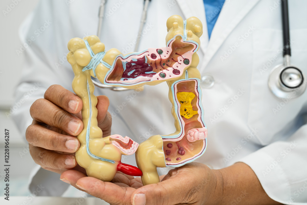 Intestine, appendix and digestive system, doctor holding anatomy model ...