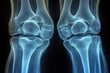 © ChaoticMind - Detailed view of human knee joints showing bones and cartilage in x-ray format