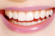 © Siasart Stock - Close-up of a woman's perfect smile reveals bright, healthy, white teeth perfectly aligned, beautifully.