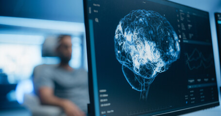 Aufkleber - Medical Brain Scans on Multiple Computer Screens. Advanced Neuroimaging Technology Reveals Complex Neural Pathways, Display Showing CT Scan in a Modern Medical Environment