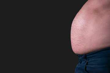 obese man belly fat side view, Cushing's syndrome concept, diabetes concept, man's fat abdomen 