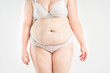 © staras - Tummy tuck, flabby skin with stretch marks on a fat belly, plastic surgery concept on light gray background