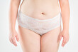 © staras - Tummy tuck, flabby skin on a fat belly, plastic surgery concept on gray background