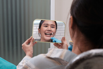 Wall Mural - Asian young female patient checks tooth implant color shades whitening, beautiful personalities in mirror in dental clinics, orthodontic, and mouth hygiene dentistry healthcare in doctor's hospital.