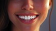 © Johannes - A beautiful model woman smiling with clean teeth.