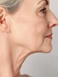 © Business Pics - Neck of elderly woman with signs of skin aging before and after facelift rejuvenation