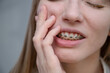 © Михаил Решетников - Close-up portrait of a red-haired girl suffering from pain due to braces. Young woman corrects bite with orthodontic appliance.