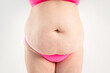 © staras - Tummy tuck, flabby skin with stretch marks on a fat belly, plastic surgery concept on gray background