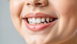 © Margarita - Close-up of smiling woman showcasing healthy teeth on neutral background for dental health blogs, wellness websites, marketing materials, and educational resources