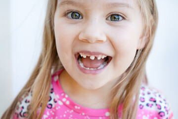 close-up portrait of a cute caucasian preschool girl with a loose tooth. toothless smile. losing bab