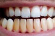 © dgpatel - Dentist holding dental teeth shade guide chart, choosing right emanel color for male patient, closeup shot, Generative AI