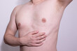 © Alina_Stor - Close up of skin rashes and irritation on man chest caused by viral infection, dermatitis or allergic reaction.