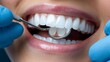 © Teresaart - Close-Up of Dentist Examining Patient's Teeth with Stomatological Mirror and Brush in High-Quality Medical Setting