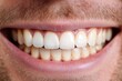 © Ева Поликарпова - Close-up of a person's mouth showing a gap where a tooth is missing