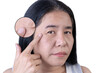 © maemodnit13 - Enlarged circles indicate facial of woman with wrinkles, crow's feet at the corners of eyes