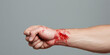 © Lila Patel - Male Forearm and Hand with Laceration and Bleeding