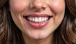 © Baron Von Fedorov - Bright smile showcasing white teeth sparkle, confidence and beauty