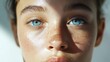 © Chotijah - Young Woman With Freckles and Bright Blue Eyes