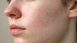 © Di - Close-up of a person's face with visible skin texture, showcasing natural imperfections and healthy glow, representing authenticity and self-confidence in beauty.