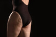 © New Africa - Woman with cellulite problem on black background, closeup. Space for text