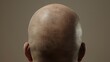© Наталья Добровольска - A shiny bald scalp reflecting light, symbolizing hair loss and skin texture.