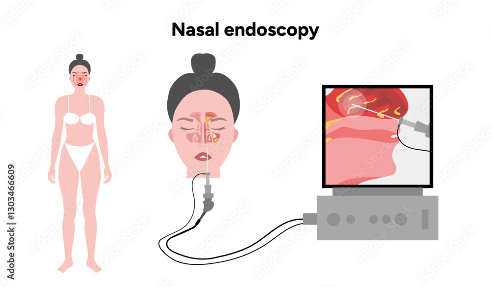 Nose Inspection Device Image vectorielle Stock Nasal endoscopy procedure nasal and sinus ...