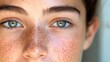© Lesuna - Close-up portrait of freckled young woman