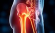 © Five Million Stock - Hip bone cancer or tumor, one side pain. 3d illustration,