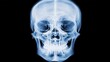 © warunthorn - Detailed Skull X-ray Image Highlighting Human Anatomy Structures