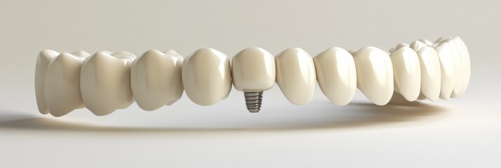 Aufkleber - Detailed 3D model showcasing a dental arch featuring a single implant surrounded by natural teeth for educational purposes Generative AI