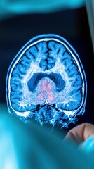 Leinwandbilder - Neurotechnology Insights Advanced MRI Brain Scan Visualization for Precision Medicine, Cognitive Research, and Next-Gen Diagnostic Imaging Innovation